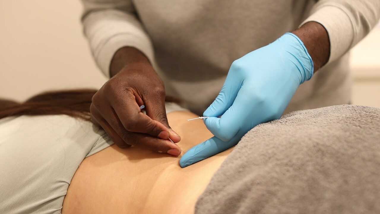 Dry needling treatment applied to a patient's back