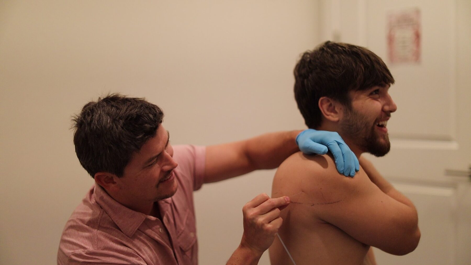 A therapist performing dry needling on a patient's shoulder at Acadiana Pain & Performance Rehab