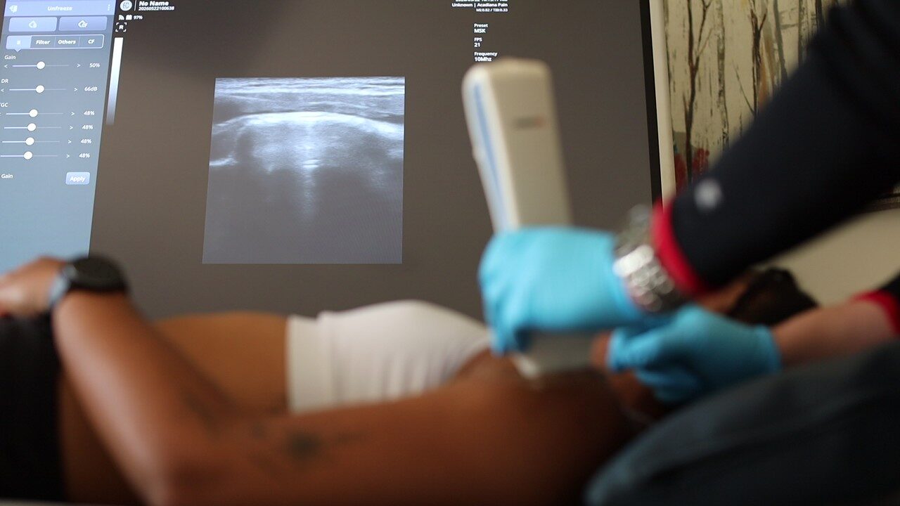 A clinician using a handheld ultrasound probe to guide treatment while viewing live imaging on screen